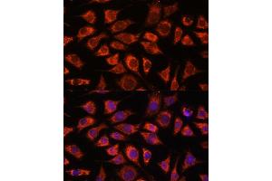 Immunofluorescence analysis of L929 cells using PI4KB antibody (ABIN7269287) at dilution of 1:100. (PI4KB anticorps  (AA 560-801))