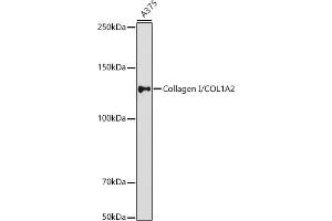 Western blot analysis of extracts of  cells, using Collagen I/COL1 antibody (ABIN6134502, ABIN6138839, ABIN6138840 and ABIN6221469) at 1:1000 dilution. (COL1A2 anticorps  (AA 500-600))