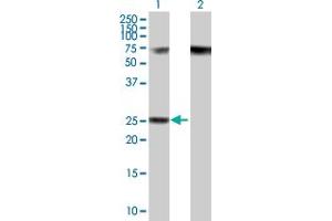Western Blot analysis of RPP40 expression in transfected 293T cell line by RPP40 MaxPab polyclonal antibody. (RPP40 anticorps  (AA 1-244))