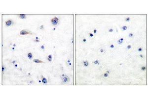 Immunohistochemistry (IHC) image for anti-Neurotrophic Tyrosine Kinase, Receptor, Type 2 (NTRK2) (pTyr515) antibody (ABIN1847226) (TRKB anticorps  (pTyr515))