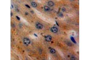 Used in DAB staining on fromalin fixed paraffin-embedded Liver tissue (a2PI (AA 340-491) anticorps)