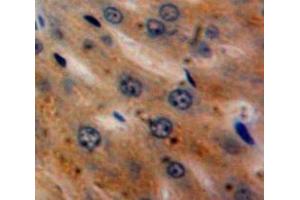 Used in DAB staining on fromalin fixed paraffin-embedded Liver tissue (alpha 2 Antiplasmin anticorps  (AA 340-491))