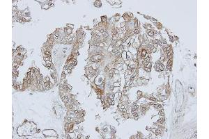 IHC-P Image Immunohistochemical analysis of paraffin-embedded OVCA xenograft, using TRHR, antibody at 1:100 dilution. (TRHR anticorps  (C-Term))