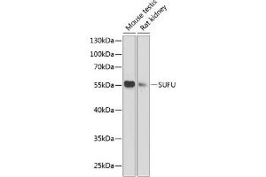 Western blot analysis of extracts of various cell lines, using SUFU antibody (ABIN6133029, ABIN6148692, ABIN6148694 and ABIN6217424) at 1:1000 dilution.