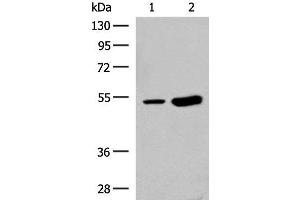 Western blot analysis of Human left thymus tissue and Mouse kidney tissue lysates using ZBTB43 Polyclonal Antibody at dilution of 1:250 (ZBTB43 anticorps)