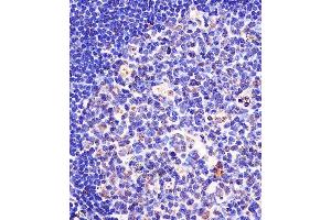 (ABIN657676 and ABIN2846668) staining SF3B1 in human tonsil tissue sections by Immunohistochemistry (IHC-P - paraformaldehyde-fixed, paraffin-embedded sections). (SF3B1 anticorps  (N-Term))