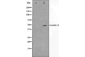 Western blot analysis on HT29 cell lysate using Keratin 18 Antibody.