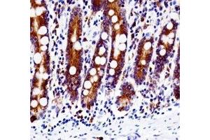 Src antibody immunohistochemistry analysis in formalin fixed and paraffin embedded human small intestine tissue