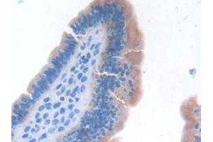 Detection of TNFa in Mouse Uterus Tissue using Monoclonal Antibody to Tumor Necrosis Factor Alpha (TNFa) (TNF alpha anticorps  (AA 80-235))