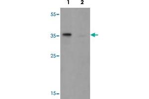 Western blot analysis of TSPY1 in A-20 cell lysate with TSPY1 polyclonal antibody  at 1 ug/mL in (1) the absence and (2) the presence of blocking peptide.