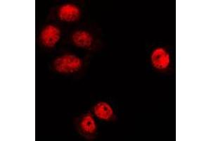 Immunofluorescent analysis of MGCRACGAP staining in K562 cells.