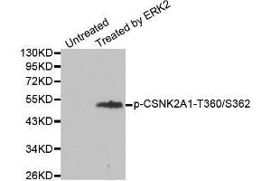 Western blot analysis of extracts from 293 cells, using Phospho-CSNK2A1-T360/S362 antibody. (CSNK2A1/CK II alpha anticorps  (pSer362, pThr360))