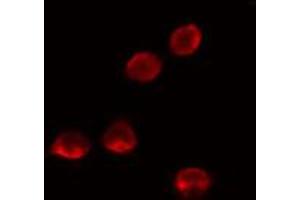 ABIN6274136 staining LOVO cells by IF/ICC. (MED26 anticorps  (N-Term))