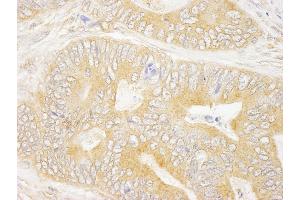 Immunohistochemistry (IHC) image for anti-Growth Factor Receptor-Bound Protein 10 (GRB10) (AA 100-150) antibody (ABIN7448583)