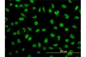 Immunofluorescence of monoclonal antibody to SNAI2 on HeLa cell. (SLUG anticorps  (AA 97-169))