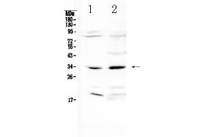 Western blot analysis of MyD88 using anti-MyD88 antibody .