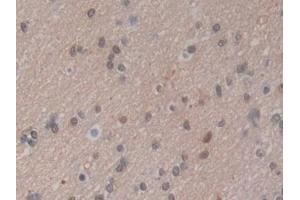 Detection of HSPA1A in Human Brain Tissue using Polyclonal Antibody to Heat Shock 70 kDa Protein 1A (HSPA1A)