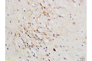 Formalin-fixed and paraffin-embedded rat brain labeled with Rabbit Anti-Versican Polyclonal Antibody, Unconjugated 1:200 followed by conjugation to the secondary antibody and DAB staining