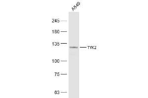 A549 lysates probed with TYK2 Polyclonal Antibody, Unconjugated  at 1:500 dilution and 4˚C overnight incubation. (TYK2 anticorps  (AA 401-500))