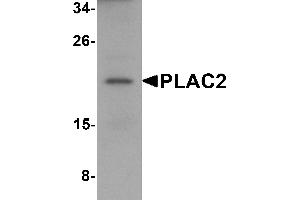 Western Blotting (WB) image for anti-Tissue Differentiation-Inducing Non-Protein Coding RNA (TINCR) (Middle Region) antibody (ABIN1031042)