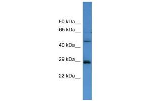 WB Suggested Anti-SPR Antibody Titration: 0. (SPR anticorps  (C-Term))