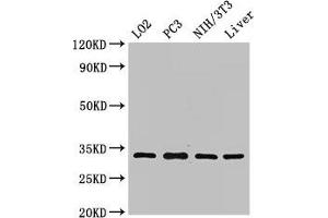 Western Blot Positive WB detected in: LO2 whole cell lysate, PC-3 whole cell lysate, NIH/3T3 whole cell lysate, Rat liver tissue All lanes: SIX1 antibody at 2. (SIX Homeobox 1 anticorps  (AA 144-262))