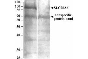 AP32082PU-N SLC26A6 Antibody staining of Human renal cortical brush-border membrane lysate at 10 µg/ml (90 µg protein denatured at 37°C for 30min) with (B) and without (A) blocking with the immunizing peptide. (SLC26A6 anticorps  (Internal Region))