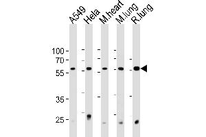 PRS4 Antibody (C-term) (ABIN1881692 and ABIN2843376) western blot analysis in A549,Hela cell line and mouse heart and lung,rat lung tissue lysates (35 μg/lane). (PSMC1 anticorps  (C-Term))
