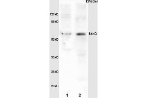 L1 mouse brain lysates L2 mouse embryo lysates probed with Anti Phospho-MEF2A (Ser408) Polyclonal Antibody, Unconjugated (ABIN743783) at 1:200 overnight at 4 °C. (MEF2A anticorps  (pSer408))