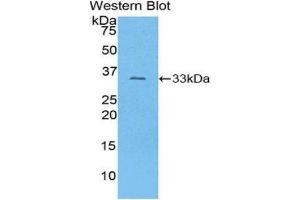 Western Blotting (WB) image for anti-Collagen, Type I, alpha 1 (COL1A1) (AA 1225-1453) antibody (ABIN1077674) (COL1A1 anticorps  (AA 1225-1453))