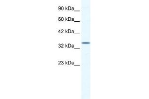 WB Suggested Anti-ZFP589 Antibody Titration:  1. (ZFP589 (Middle Region) anticorps)