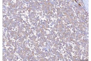 IHC analysis of EIF5A using anti-EIF5A antibody (ABIN7602568).