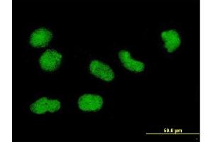 Immunofluorescence of monoclonal antibody to H3F3B on HeLa cell.