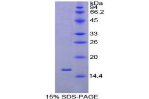 SDS-PAGE (SDS) image for Vascular Endothelial Growth Factor A (VEGFA) protein (His tag) (ABIN1081127)