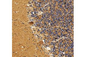 IHC analysis of DNM3 using anti-DNM3 antibody (ABIN7601163). (Dynamin 3 anticorps  (AA 295-712))