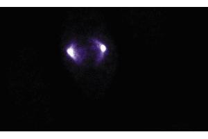 Immunofluorescence staining of human endothelial cells. (Aurora A anticorps  (AA 8-116))