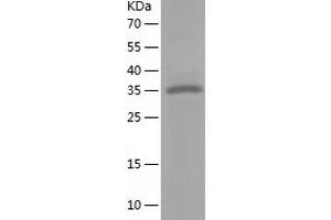Western Blotting (WB) image for Nuclear Factor of kappa Light Polypeptide Gene Enhancer in B-Cells Inhibitor, delta (NFKBID) (AA 1-313) protein (His-IF2DI Tag) (ABIN7124207)