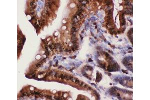 IHC-P: Caspase-3 antibody testing of mouse intestine tissue (Caspase 3 anticorps  (AA 67-175))