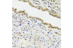 Immunohistochemistry of paraffin-embedded rat liver using EFTUD2 Antibody.