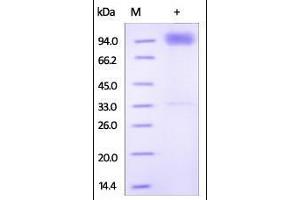 SDS-PAGE (SDS) image for Interleukin 18 Receptor 1 (IL18R1) (AA 19-329) protein (Fc Tag) (ABIN2181354)