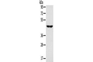 Western Blotting (WB) image for anti-Monocarboxylate Transporter 3 (MCT3) antibody (ABIN2433812) (MCT3 anticorps)