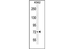Western blot analysis of PAK6 Antibody (Center) in K562 cell line lysates (35ug/lane). (PAK6 anticorps  (Middle Region))