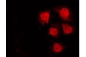 ABIN6272615 staining A549 by IF/ICC.