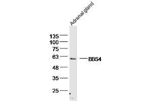 Mouse adrenal gland lysates probed with BBS4 Polyclonal Antibody, unconjugated  at 1:300 overnight at 4°C followed by a conjugated secondary antibody for 60 minutes at 37°C. (BBS4 anticorps  (AA 431-519))