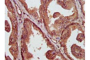 IHC image of ABIN7158882 diluted at 1:400 and staining in paraffin-embedded human prostate tissue performed on a Leica BondTM system.