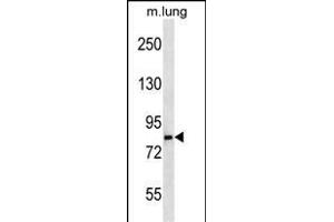 LRS Antibody (N-term) (ABIN656897 and ABIN2846096) western blot analysis in mouse lung tissue lysates (35 μg/lane). (LRSAM1 anticorps  (N-Term))