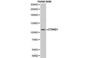 Western Blotting (WB) image for anti-Catenin (Cadherin-Associated Protein), delta 1 (CTNND1) antibody (ABIN1872087) (CTNND1 anticorps)