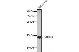 Western blot analysis of extracts of Rat spleen using S100A9 Polyclonal Antibody at dilution of 1:1000. (S100A9 anticorps)