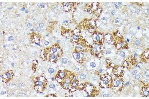Immunohistochemistry of paraffin-embedded Rat liver using WNT1 Polyclonal Antibody at dilution of 1:100 (40x lens). (WNT1 anticorps)