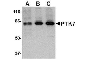 Image no. 1 for anti-PTK7 Protein tyrosine Kinase 7 (PTK7) (N-Term) antibody (ABIN318893) (PTK7 anticorps  (N-Term))